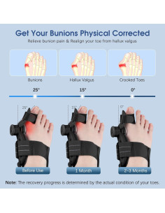Corrector de Juanetes KASHEVI Ajustable para Alivio del Dolor 2