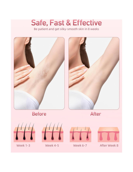 Eliminador de Vello IPL TYHGSF TFDA06S-A 999,999 Destellos