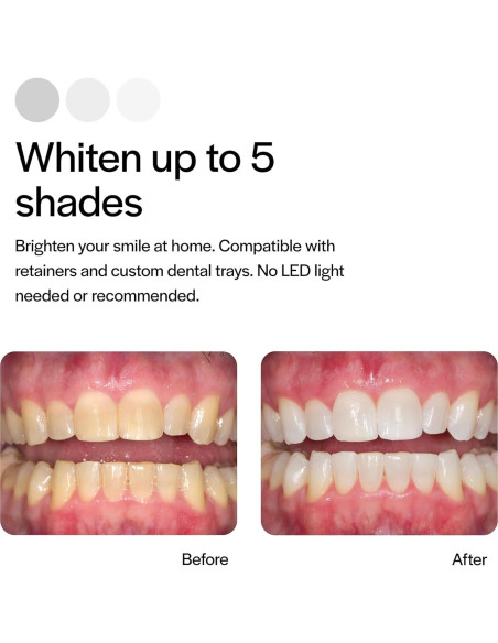 Gel Blanqueador Dental Opalescence 35% Menta - 4 Jeringas