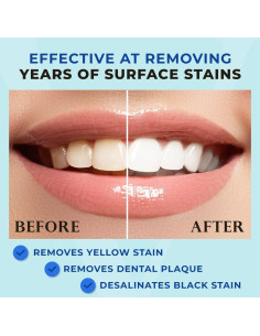 Pluma Blanqueadora de Dientes Venus Visage - 20+ Usos 2