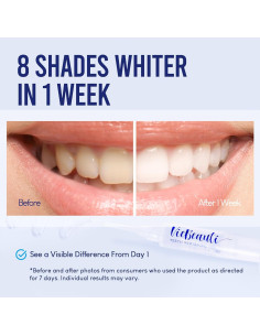 Kit Blanqueamiento Dental VieBeauti LED 35% Peróxido Menta 2