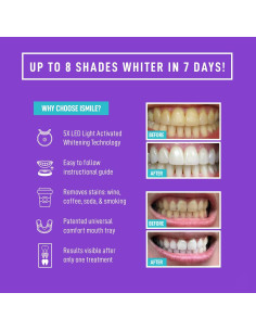 Kit Blanqueamiento Dental iSmile - Luz LED, 35% Peróxido 2