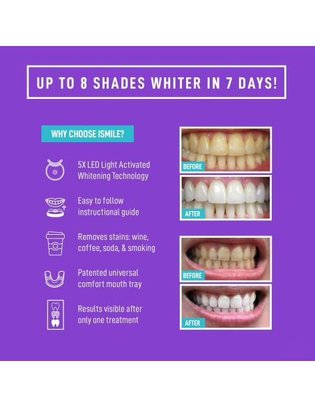 Kit Blanqueamiento Dental iSmile - Luz LED, 35% Peróxido