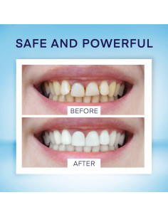 Bolígrafo Blanqueador de Dientes AsaVea 40+ Usos Menta 2