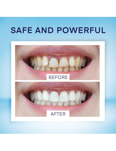 Bolígrafo Blanqueador de Dientes AsaVea 40+ Usos Menta