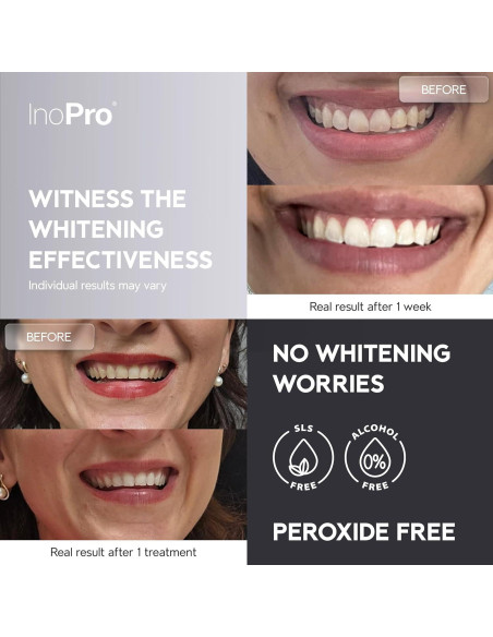 Tiras Blanqueadoras Naturales Inopro 14 Tratamientos Dientes