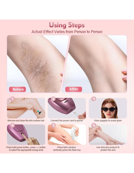 Eliminador de Vello Lásers IPL Playexen para Todo el Cuerpo