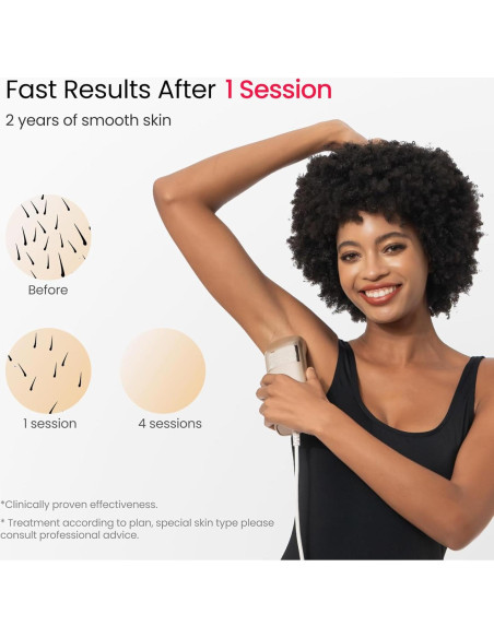 Depiladora láser IPL SALLOOT DT015 Pro 100W piel sensible