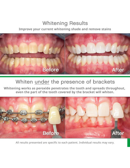 Opalescence GO 15% - 10 Kits Blanqueamiento Dental Menta