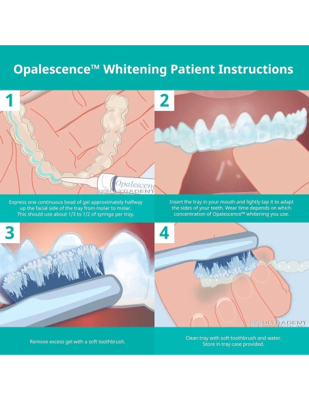 Kit Blanqueamiento Dental Opalescence 35% - 4 Jeringas