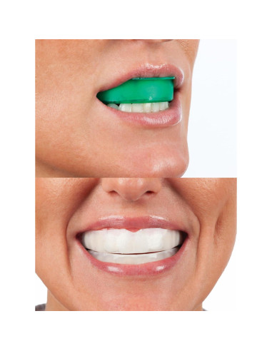 Kit Blanqueamiento Dental Opalescence 15% - 4 Tratamientos