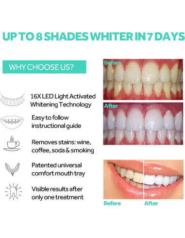 Acelerador Blanqueamiento Dental PHOEBE Luz LED Azul 16x