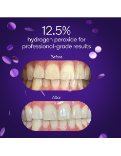 Kit Blanqueamiento Dental Burst 3 Tratamientos 12.5% Peróxido 2