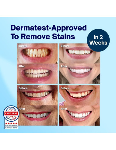 Polvo Blanqueador de Dientes MySweetSmile - Sin Peróxido