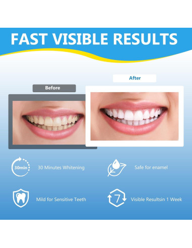 Tiras Blanqueadoras Milumber para Dientes Sensibles 42 Tiras