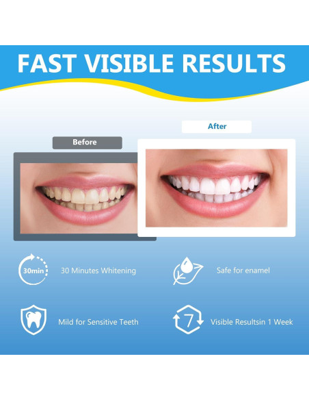 Tiras Blanqueadoras Milumber para Dientes Sensibles 42 Tiras