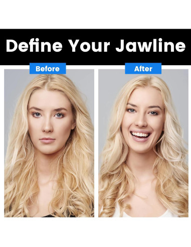 Ejercitador de Mandíbula TEAWOO 3 Niveles Resistencia