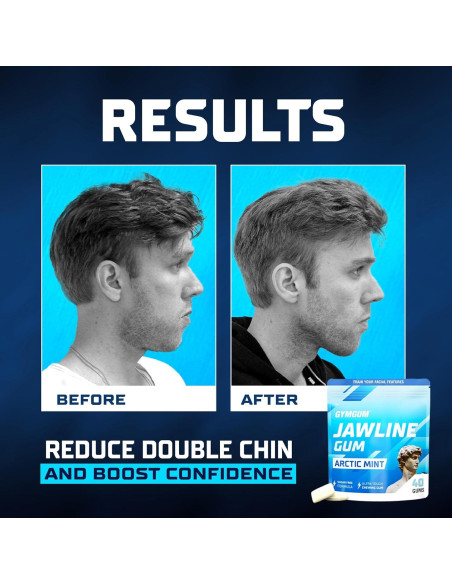 Chicle de Mandíbula GYMGUM Menta Ártica 40 Unidades