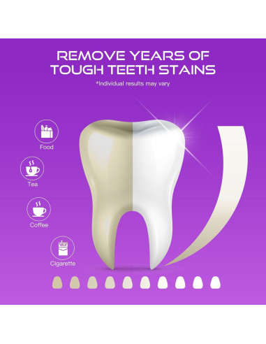 Tiras Blanqueadoras de Dientes Amkuqzt - 28 Tiras (14 Tratamientos)