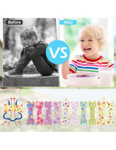 30 Tiras Nasales para Niños Aartner Antironquidos Coloridas 2
