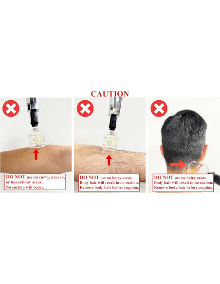 Juego de Ventosas Profesionales KS AG con Bomba y Tubo - 17 Piezas