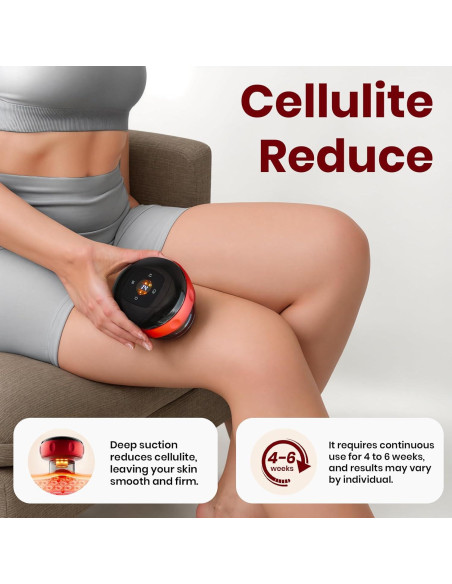 Juego de Ventosas Eléctricas Becommend 5-en-1 con Calor