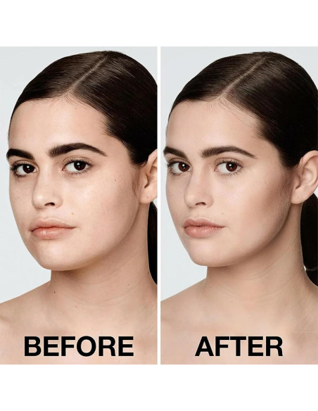 Correa Levantadora Facial JIAXIN para Doble Barbilla