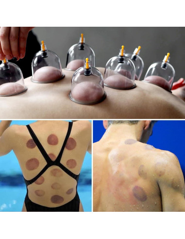 Kit de Ventosas Cupluw - 32 Copas para Masaje y Alivio