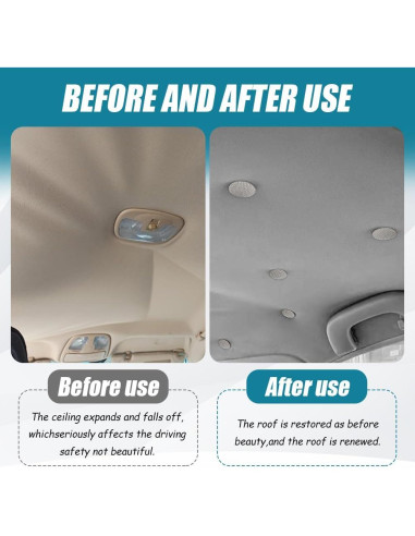 Kit de Reparación de Techo de Coche Kutyun - 24 Botones y Herramientas