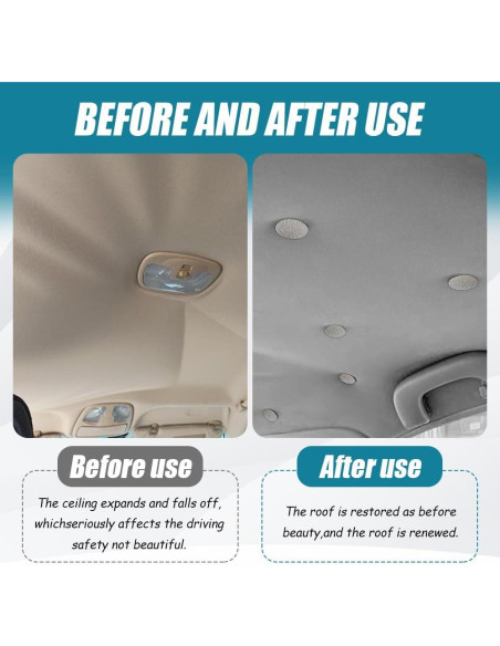 Kit de Reparación de Techo de Coche Kutyun - 24 Botones y Herramientas