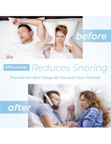 Correa de Barbilla Ajustable SyunsXoon para Ronquidos (2 Pz)