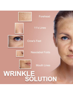 Cinta de Elevación Facial Akissos 2.5cm x 5m Antienvejecimiento 2