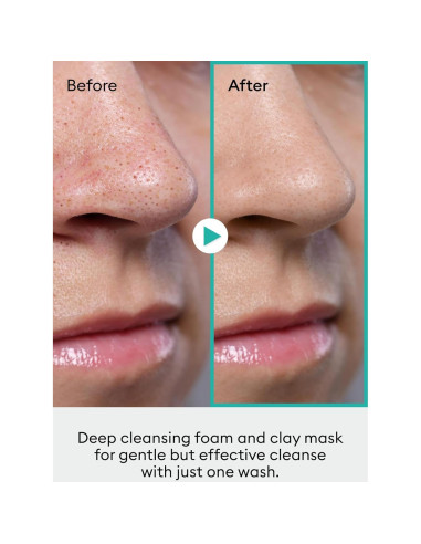 Limpiador Espumoso 2-en-1 MISSHA Artemisia 150ml - Facial y Mascarilla