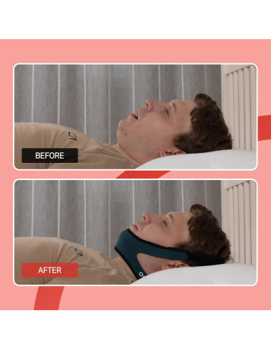 Detenedor de Ronquidos OLG Correa Barbilla CPAP Malla Transpirable