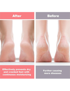 6 Pares de Calcetines Hidratantes de Silicona Vodolo para Pies 2