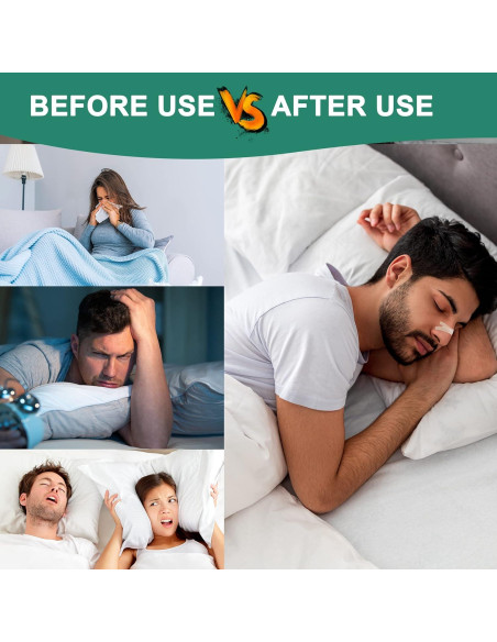 Tiras Nasales UPMOSTEK Anti Ronquidos 120 Unidades Alivio Congestión