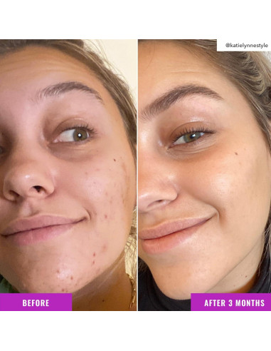 Tónico Iluminador Good Molecules 30 ml - Niacinamida y Arbutina