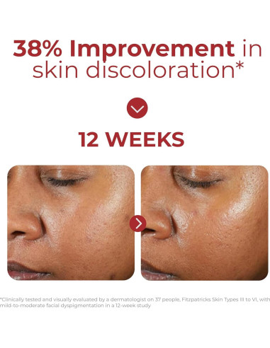 EltaMD UV Clear Protector Solar Tinteado SPF 46 48g