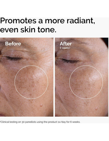 Tónico Exfoliante El Ordinario Ácido Glicólico 7% 100 ml