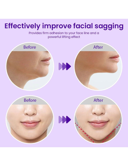 Máscara Lifting Facial Kaely 6Pcs Rojo Tamaño Pequeño