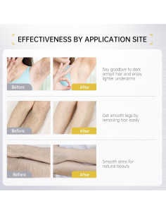 Crema Depilatoria VGO 114 g - Suave y Hipoalergénica para Todos 2