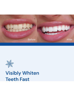 Tiras Blanqueadoras SNOW Diamond Dissolving - 14 Unidades 2