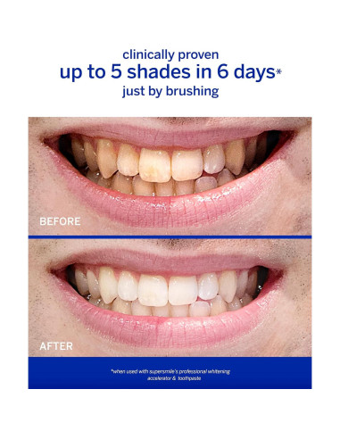 Sistema de Blanqueamiento Dental Supersmile 4.1x7x14.1cm