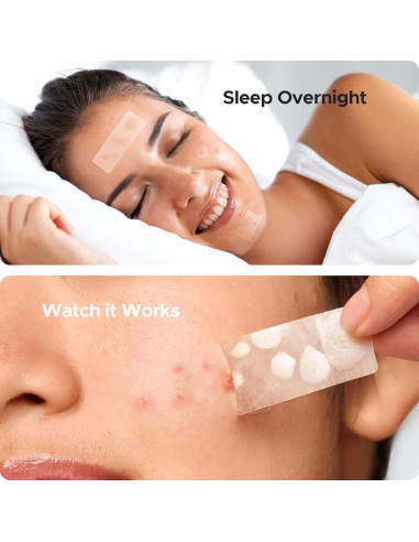 Parches para Acné TKTK - 126 Parches Hidrocoloides XL