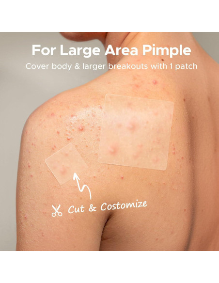 Parches para Granos XL TKTK 60 mm Hidrocoloide 62 Piezas