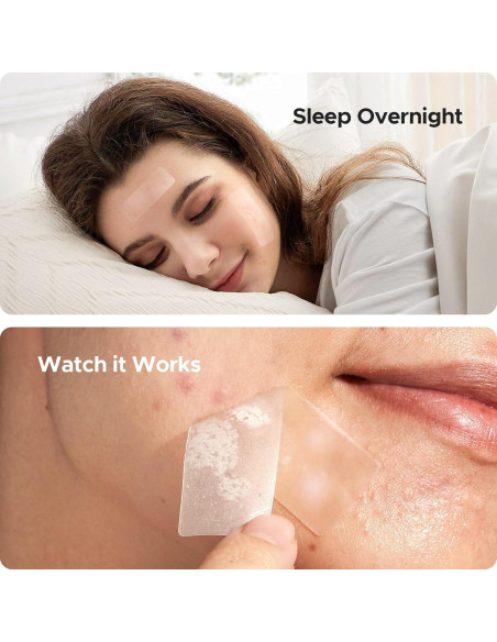 Parches para Granos XL TKTK 60 mm Hidrocoloide 62 Piezas