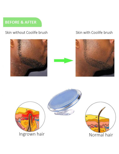 Coolife Removedor de Vello Encarnado y Exfoliante Corporal