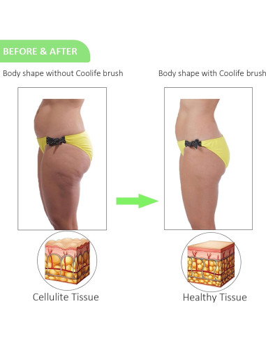 Coolife Removedor de Vello Encarnado y Exfoliante Corporal