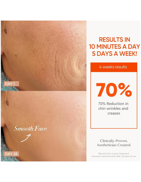 Máscara de Terapia de Luz Roja Inalámbrica ESTANANA 7 Modos Máscara de Terapia de Luz Roja Inalámbrica ESTANANA 7 Modos