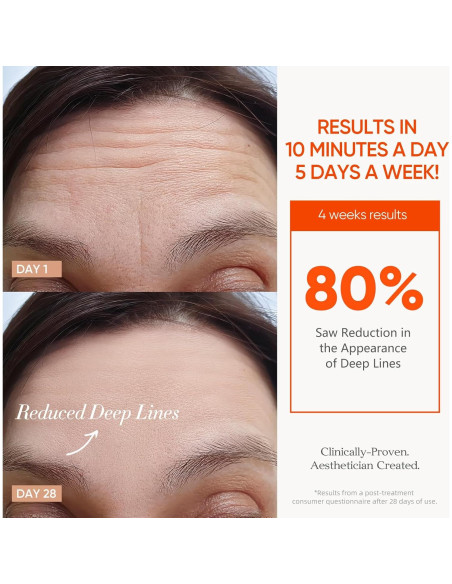 Máscara de Terapia de Luz Roja Inalámbrica ESTANANA 7 Modos Máscara de Terapia de Luz Roja Inalámbrica ESTANANA 7 Modos